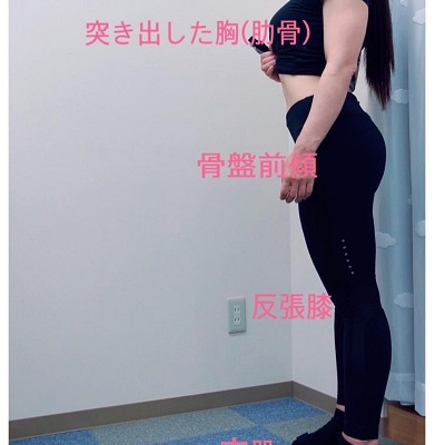 反り腰 骨盤前傾がもたらす身体への影響 高槻市 高槻芥川you整骨院 Blog 高槻芥川you整骨院 女性柔整師による身体お悩み相談室