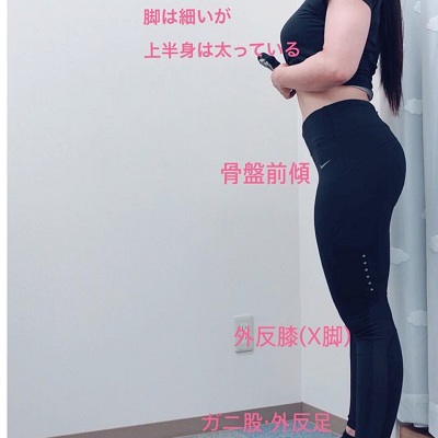 骨格 筋バランスが崩れる反り腰 骨盤前傾 姿勢 高槻市 高槻芥川you整骨院 Blog 高槻芥川you整骨院 女性柔整師による身体お悩み相談室