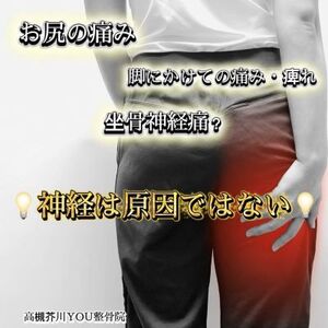 神経ではない！？「お尻の痛み・脚にかけての痛み」真因は？　高槻市「高槻芥川YOU整骨院」
